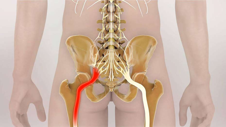Анатомия седалищного нерва