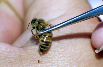 Укус пчелы при грыжи поясничной thumbnail
