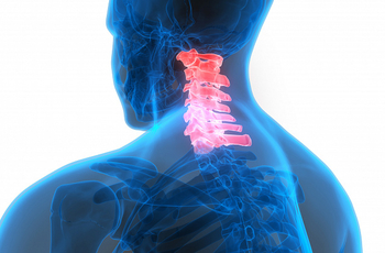 Цервикокраниалгия - это боль в шее и затылочной области, которая вызывается травмой, воспалительным или дегенеративным процессом в шейном отделе позвоночника. Это заболевание имеет второе название - шейная мигрень или синдром позвоночного нерва.