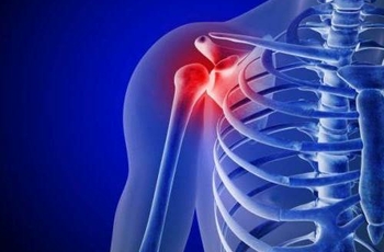 Главной функцией плечевой кости является обеспечение рук способностью к разнообразным движениям. Наиболее частая локализация переломов в этой части тела – шейка кости. При травмах объем движений в руке значительно ограничивается.