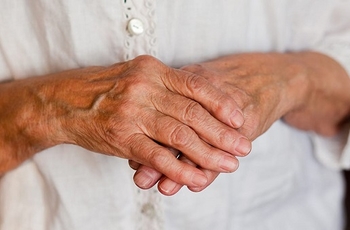 Полиартрит - это воспалительный процесс, поражающий суставы человека. Самый распространенной формой является полиартрит кистей рук. Важно помнить, что правильный диагноз может поставить только врач-ревматолог. Наряду с медикаментозными, широкой популярностью пользуются и народные методы лечения. 